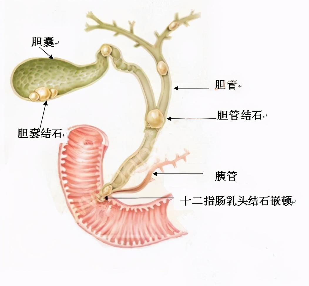 长痛不如短痛怎么接下一句_长痛不如短痛_长痛不如短痛怎么表达