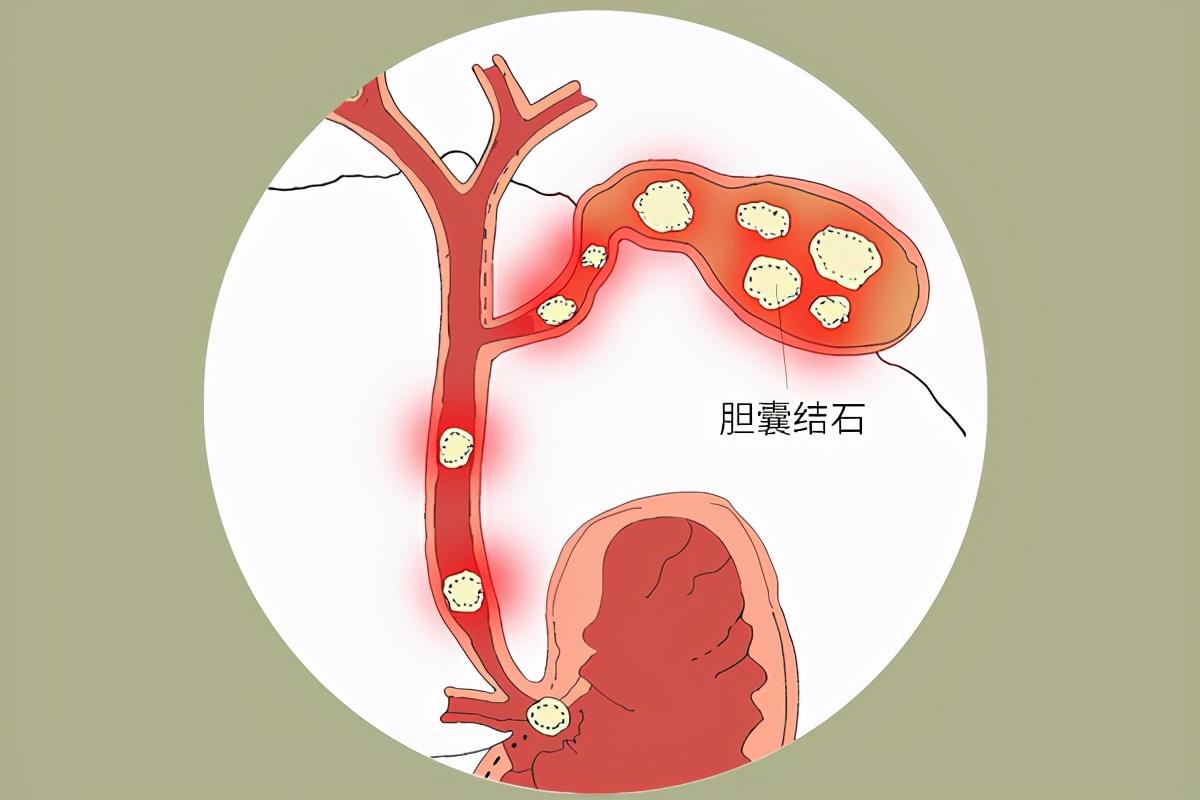 荤腥的荤最初指的是什么_荤腥_荤腥分别是什么