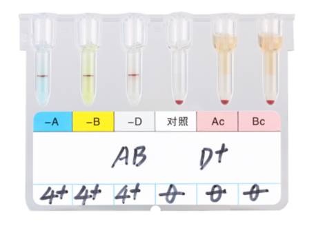 血型有几种_血型如何鉴定_血型